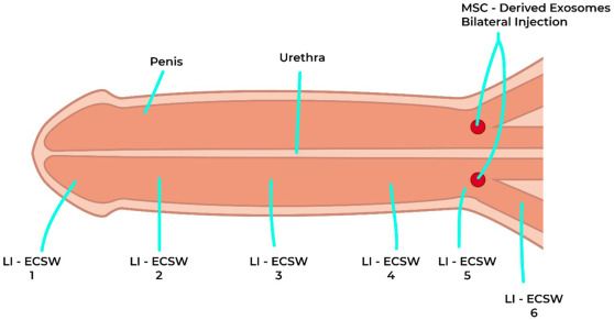 What to Expect from Treatment